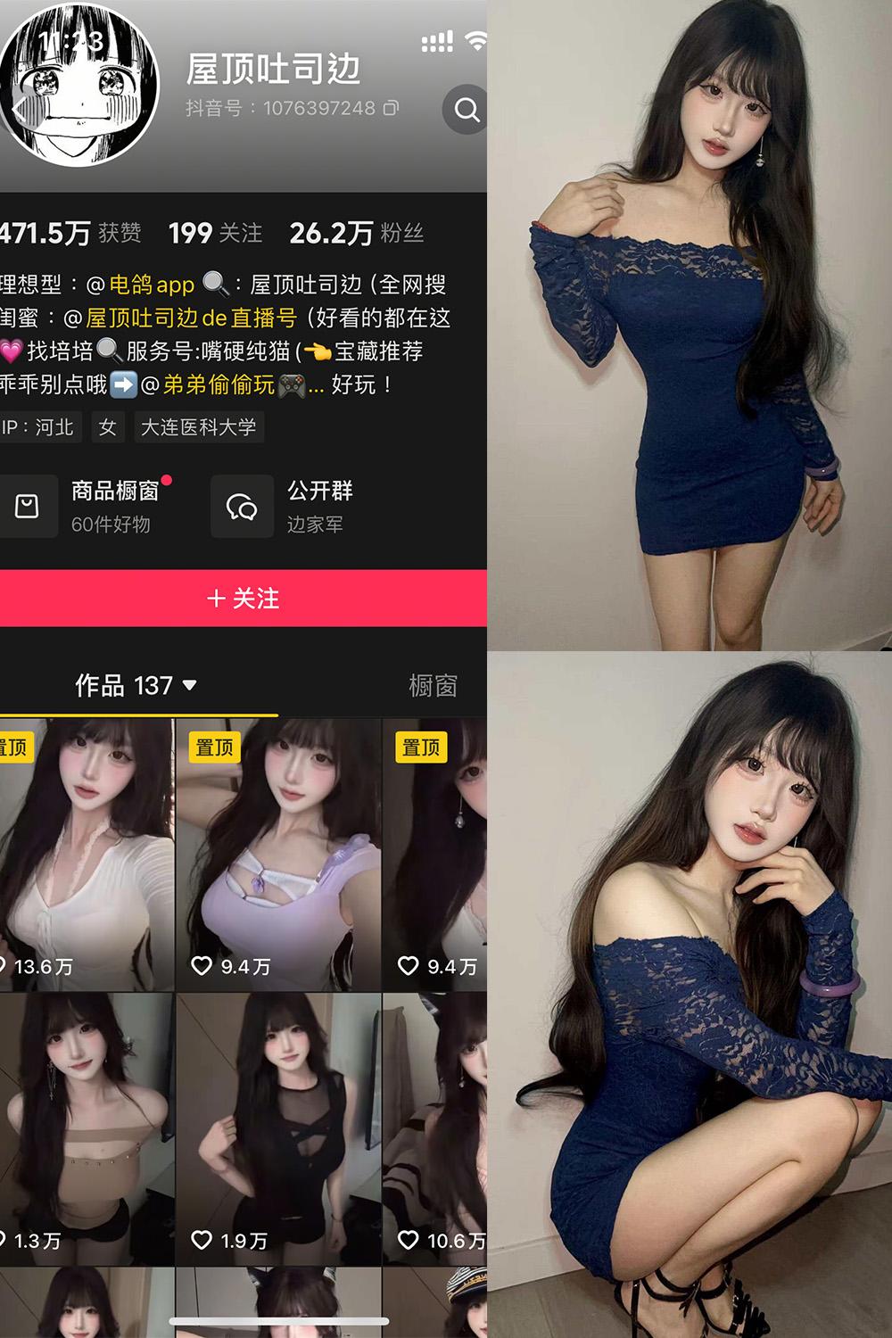 抖音 屋顶吐司边 岛遇图包 NO.001期 【10P11V】