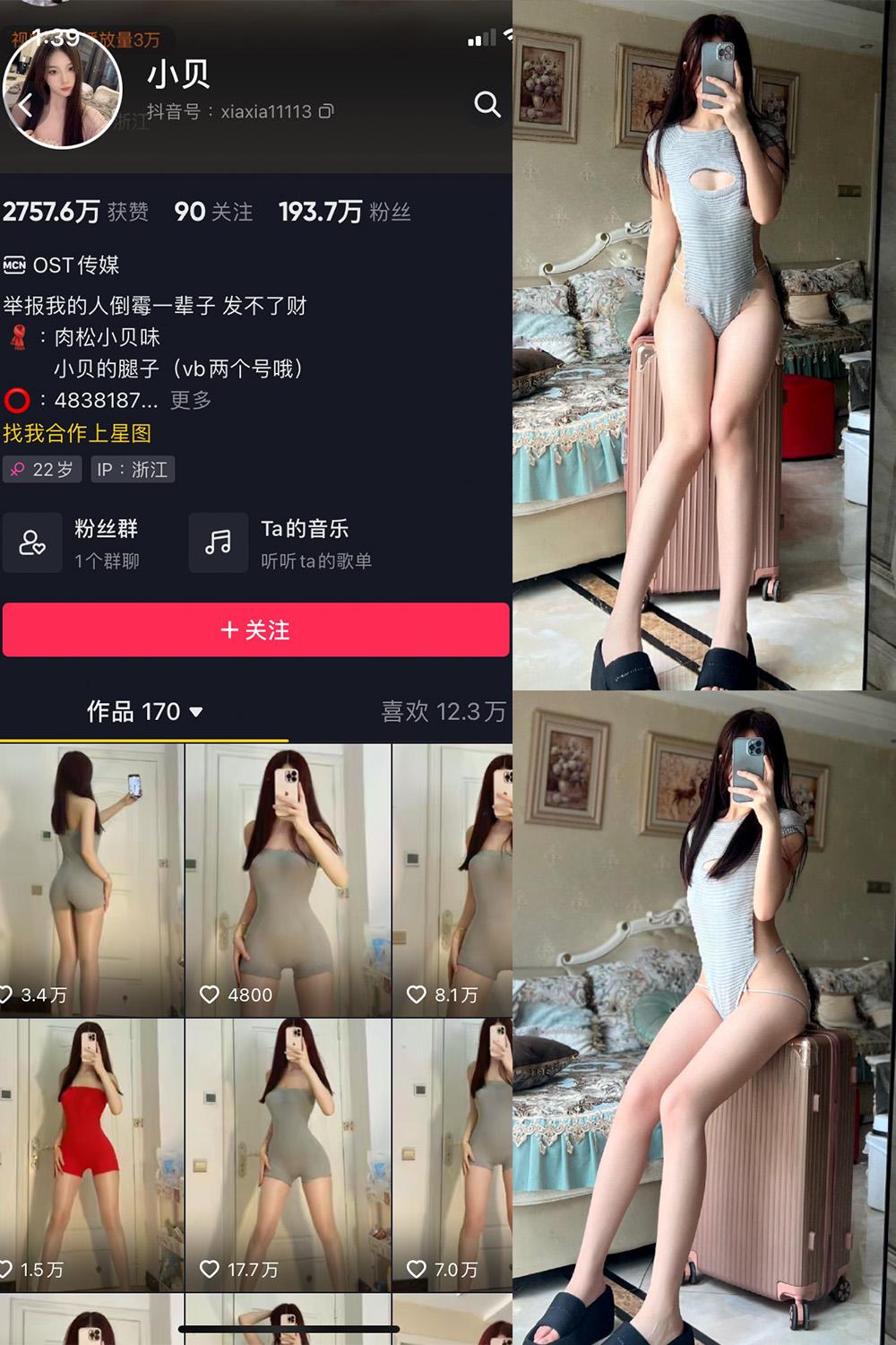 抖音 小贝 VIP 微密圈图包资源  NO.007期 【28P】