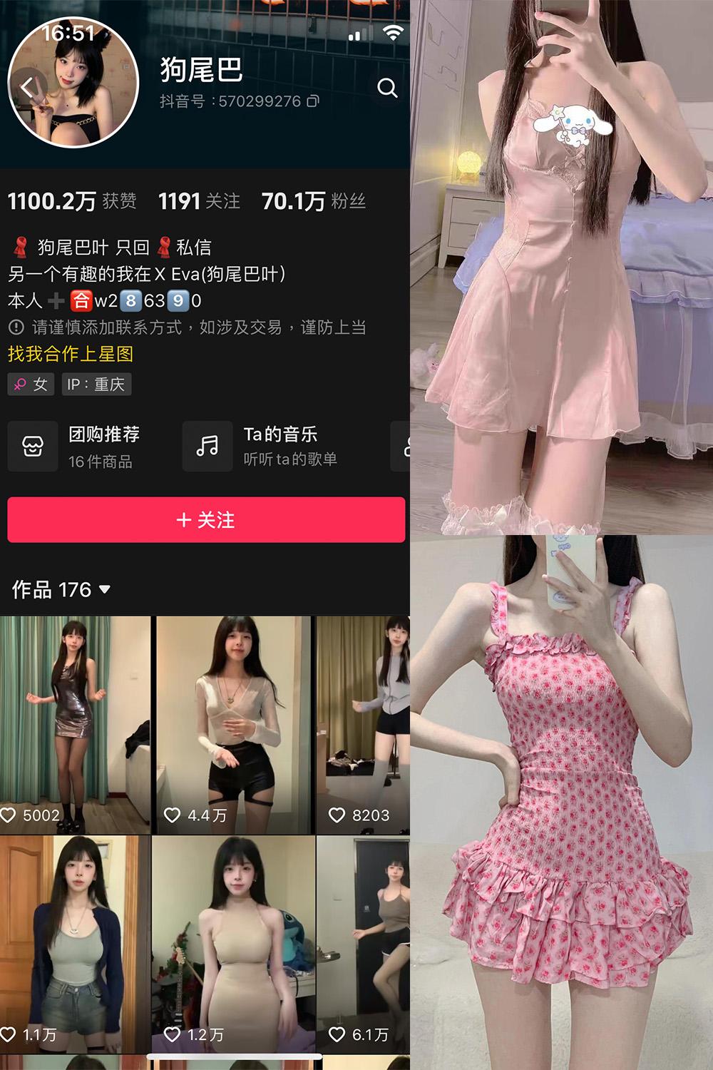 抖音 狗尾巴 微密圈图包资源  NO.004期 【25P5V】